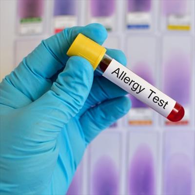 پاورپوینت (اسلاید) روش های نوین ارزیابی آلرژی در خون